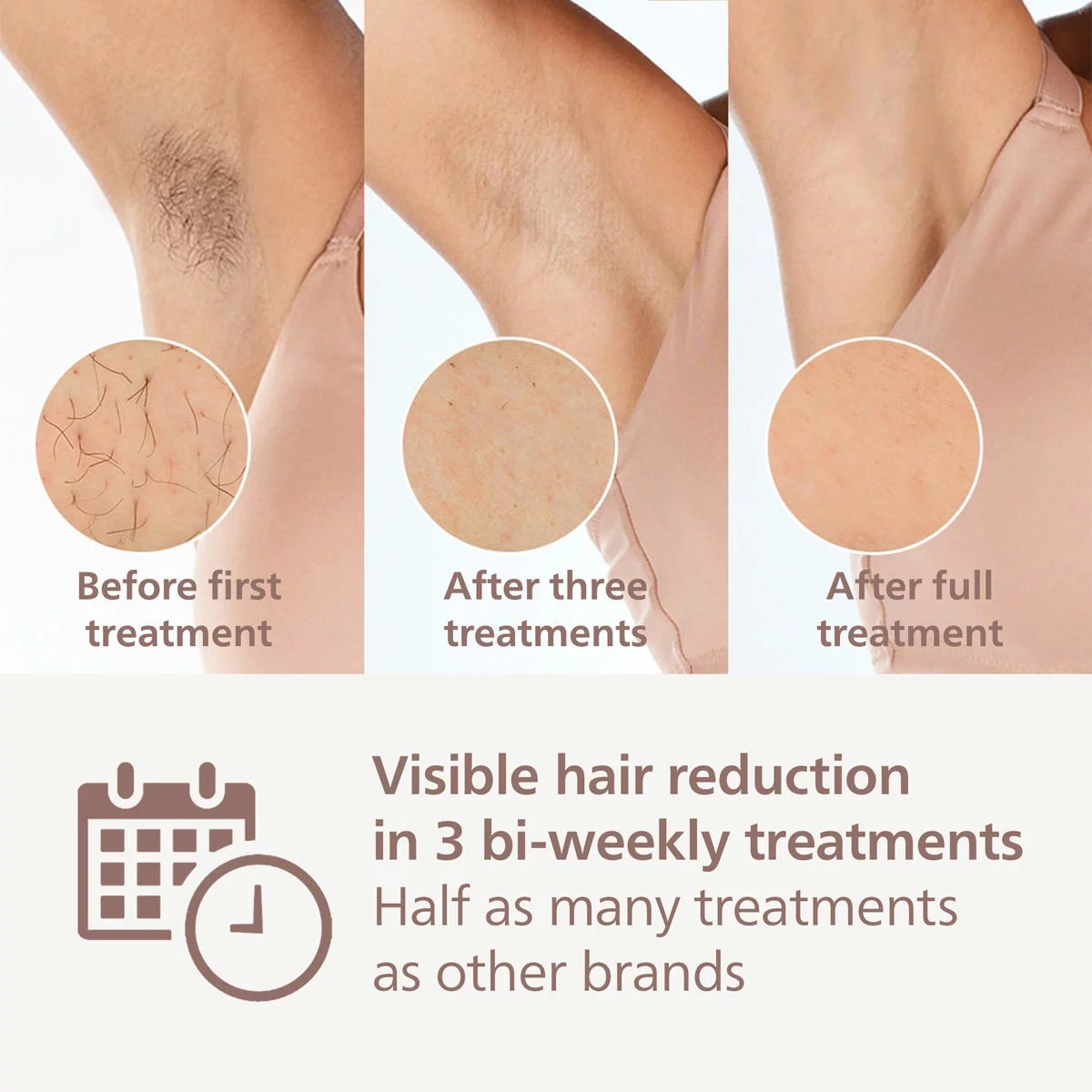 Philips BRI958/00 9000 Series Lumea IPL Hair Removal Device, view 3